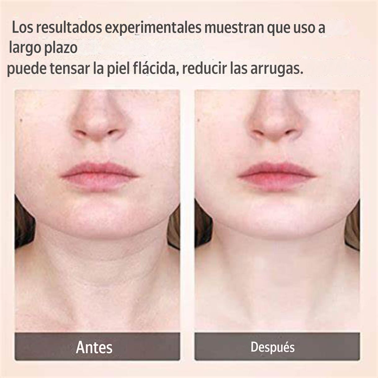 Masajeador Reafirmante Facial LED