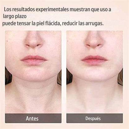 Masajeador Reafirmante Facial LED